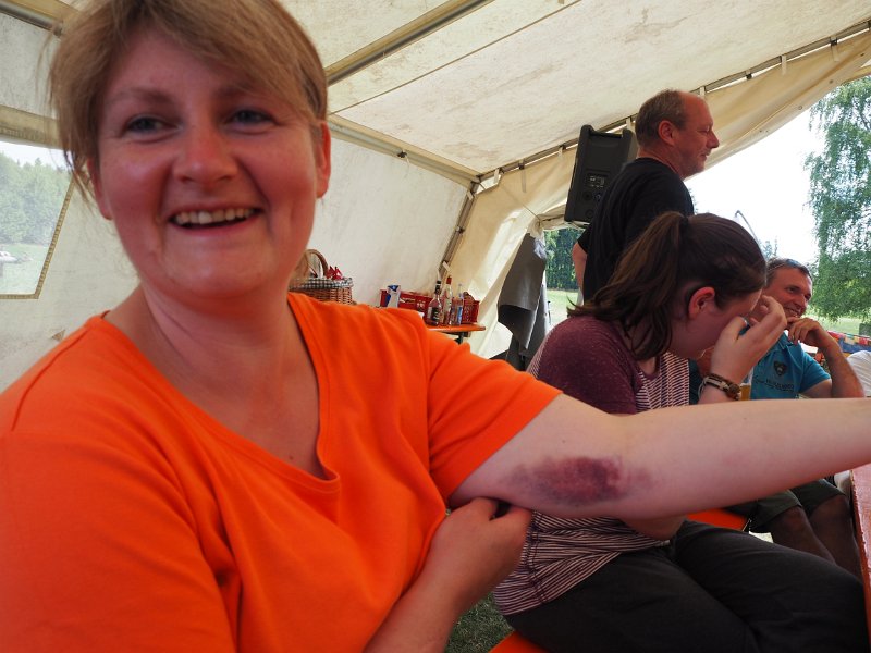 A_Zeltlager_2017_So_Re_03.JPG - Bogenschießen macht blaue Flecken, oder war's vielleicht eine andere Sportart?